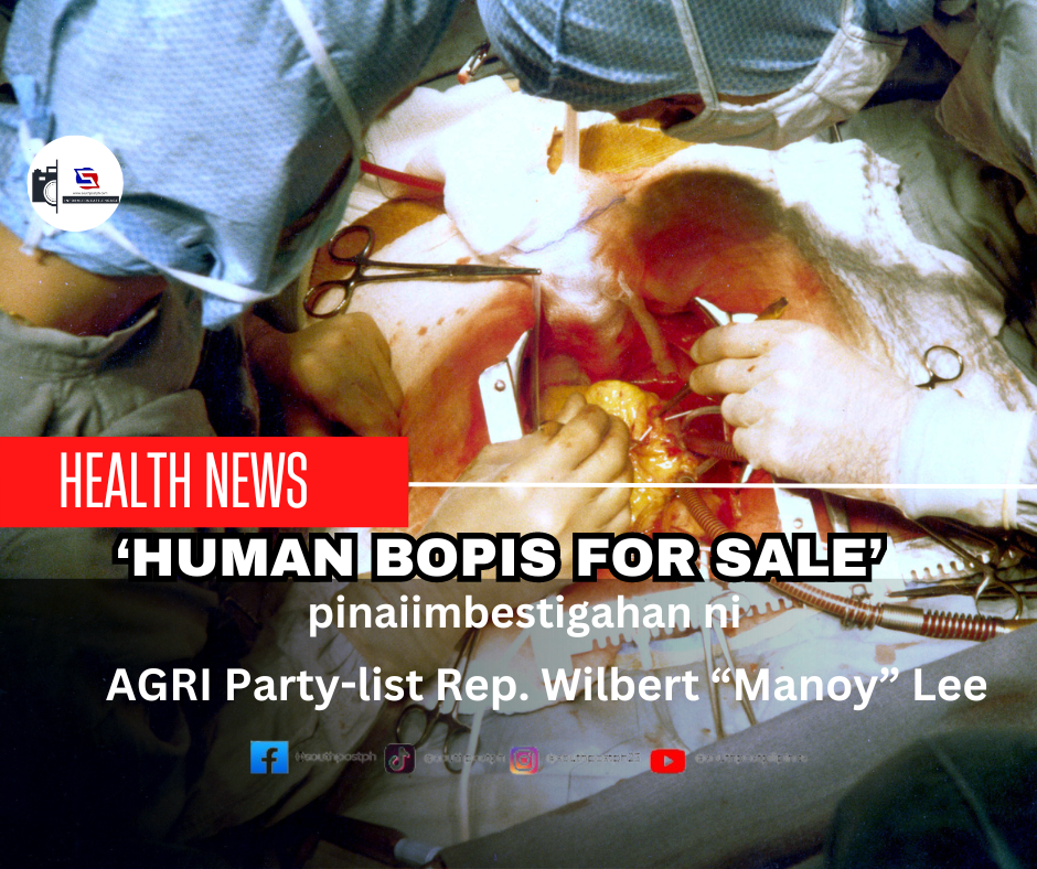 ‘HUMAN BOPIS for sale’ pina-iimbestigahan ni Lee